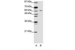 Image no. 2 for anti-CUGBP, Elav-Like Family Member 2 (CELF2) (AA 73-122) antibody (ABIN203186)