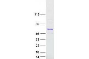 Validation with Western Blot (SOX18 Protein (Myc-DYKDDDDK Tag))