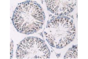 Immunohistochemistry (IHC) image for anti-Serpin Peptidase Inhibitor, Clade G (C1 Inhibitor), Member 1 (SERPING1) (AA 397-495) antibody (ABIN7438463)