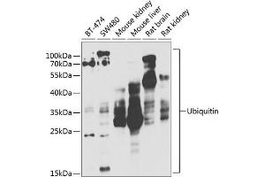 Western blot analysis of extracts of various cell lines, using Ubiquitin antibody (ABIN3022990, ABIN3022991, ABIN3022992 and ABIN6219334) at 1:1000 dilution. (Ubiquitin B Antikörper  (AA 1-76))