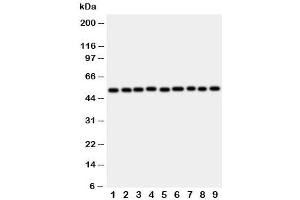 Western blot testing of E2F2 antibody and rat samples 1: lung (E2F2 Antikörper  (C-Term))