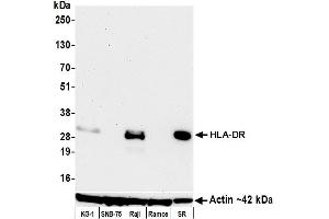 Western Blotting (WB) image for anti-HLA-DR (HLA-DR) antibody (ABIN7449537) (HLA-DR Antikörper)
