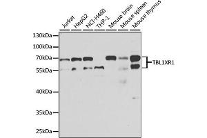 Western blot analysis of extracts of various cell lines, using TBL1XR1 antibody. (TBL1XR1 Antikörper)
