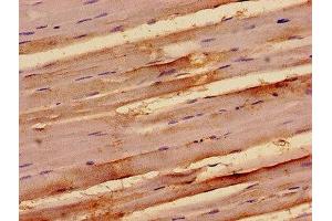 Immunohistochemistry analysis of human skeletal muscle tissue using ABIN7171966 at dilution of 1:100