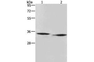 Western Blot analysis of Mouse heart and liver tissue using AMDHD2 Polyclonal Antibody at dilution of 1:500 (AMDHD2 Antikörper)