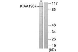 Western blot analysis of extracts from Jurkat cells, using KIAA1967 Antibody. (CCAR2 Antikörper  (AA 431-480))