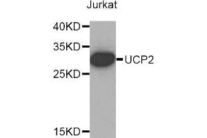 Western blot analysis of extracts of Jurkat cells, using UCP2 antibody. (UCP2 Antikörper)