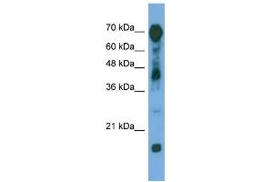 WB Suggested Anti-RAP1GAP Antibody Titration: 0. (RAP1GAP Antikörper  (Middle Region))