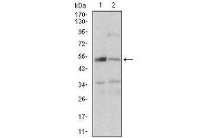 Fig. (DAPK3 Antikörper  (AA 28-161))