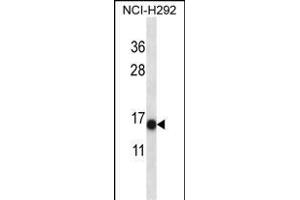 S100A7 Antibody (N-term) (ABIN657716 and ABIN2846704) western blot analysis in NCI- cell line lysates (35 μg/lane). (S100A7 Antikörper  (N-Term))