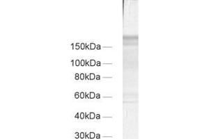dilution: 1 : 100, sample: crude synaptic membranes fraction of rat brain (LP1) (Regulating Synaptic Membrane Exocytosis 1 (RIMS1) (AA 596-705) Antikörper)