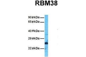 Host:  Rabbit  Target Name:  RBM38  Sample Tissue:  Human A549  Antibody Dilution:  1. (RBM38 Antikörper  (N-Term))