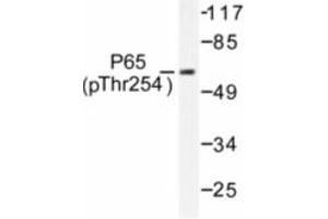 Image no. 1 for anti-Nuclear Factor-kB p65 (NFkBP65) (pThr254) antibody (ABIN318086)