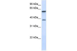 GIMAP5 antibody used at 1 ug/ml to detect target protein.