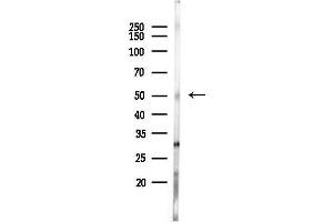 anti-Suppressor of Ty 3 Homolog (SUPT3H) (Internal Region) antibody