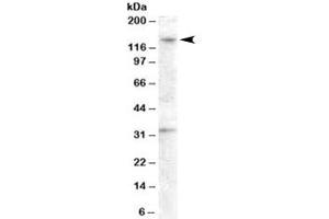 Western blot testing of human ovay lysate with GPR125 antibody at 0. (GPR125 Antikörper)