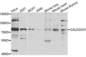 Western blot analysis of extracts of various cells, using CALCOCO1 antibody. (CALCOCO1 Antikörper)