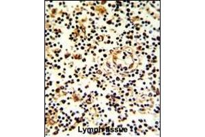 Formalin-fixed and paraffin-embedded human lymph with KLRD1 Antibody (N-term), which was peroxidase-conjugated to the secondary antibody, followed by DAB staining. (CD94 Antikörper  (N-Term))
