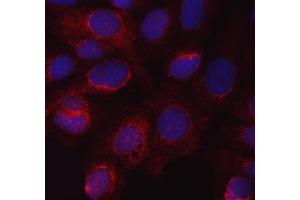 IF analysis of eNOS/NOS3 using anti-eNOS/NOS3 antibody (ABIN7601375).