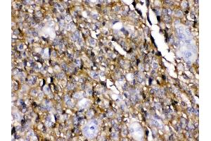 Immunohistochemistry (IHC) image for anti-Solute Carrier Family 1 (Glial High Affinity Glutamate Transporter), Member 3 (SLC1A3) (AA 14-42), (N-Term) antibody (ABIN4886724)