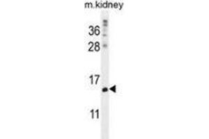 Western blot analysis in mouse kidney tissue lysates (35ug/lane) using MORN5 Antibody (C-term). (MORN5 Antikörper  (C-Term))