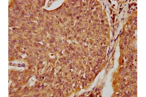 Immunohistochemistry (IHC) image for anti-serine Peptidase Inhibitor, Kazal Type 5 (SPINK5) (AA 722-847) antibody (ABIN7168929)