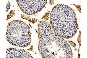 ABIN7095971 and ABIN7100033 at 1/100 staining mouse testis tissue by IHC-P. (TMED2 Antikörper)