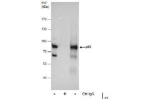 IP Image Immunoprecipitation of p63 protein from A431 whole cell extracts using 5 μg of p63 antibody [N2C1], Internal, Western blot analysis was performed using p63 antibody [N2C1], Internal, EasyBlot anti-Rabbit IgG  was used as a secondary reagent. (p63 Antikörper)