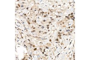 Immunohistochemistry (IHC) image for anti-Cdc2-Related Kinase, Arginine/serine-Rich (CRKRS) (AA 80-290) antibody (ABIN7266230)