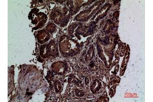 Immunohistochemistry (IHC) analysis of paraffin-embedded Human Prostate Cancer, antibody was diluted at 1:100. (CD300LG Antikörper  (Internal Region))