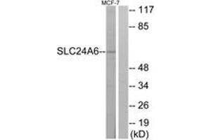 Western Blotting (WB) image for anti-Solute Carrier Family 24 (Sodium/potassium/calcium Exchanger), Member 6 (SLC24A6) (AA 494-543) antibody (ABIN2890648) (SLC24A6 Antikörper  (AA 494-543))