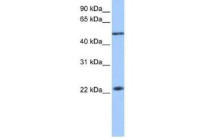 WB Suggested Anti-PIAS2 Antibody Titration: 0. (PIAS2 Antikörper  (N-Term))