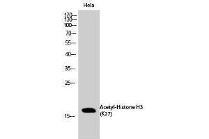 Western Blotting (WB) image for anti-Histone 3 (H3) (H3K27ac) antibody (ABIN6280295) (Histone 3 Antikörper  (H3K27ac))