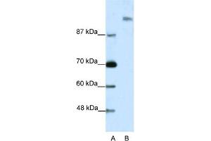 WB Suggested Anti-SUPT6H Antibody Titration:  2. (Spt6 Antikörper  (N-Term))