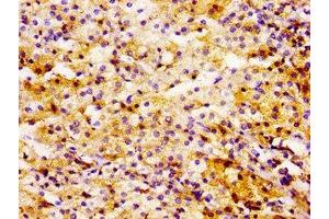 Immunohistochemistry (IHC) image for anti-Ubiquitin-Conjugating Enzyme E2L 3 (UBE2L3) (AA 1-154) antibody (ABIN7174468)
