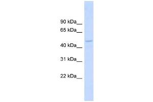 WB Suggested Anti-DBNL Antibody Titration: 0. (DBNL Antikörper  (Middle Region))