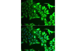 Immunofluorescence analysis of HeLa cells using  antibody (ABIN6129964, ABIN6136691, ABIN6136693 and ABIN6222112). (AIPL1 Antikörper  (AA 1-384))