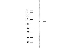 anti-Pancreatic Lipase (PNLIP) (C-Term) antibody