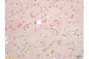 Formalin-fixed and paraffin embedded rat brain labeled with Rabbit Anti DGAT1/Diglyceride acyltransferase Polyclonal Antibody, Unconjugated (ABIN679568) at 1:200 followed by conjugation to the secondary antibody and DAB staining (DGAT1 Antikörper  (AA 251-350))