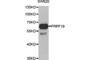 Western blot analysis of extracts of SW620 cells, using PRPF19 antibody. (PRP19 Antikörper)