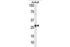 Western blot analysis of CD160 Antibody (Center) in Jurkat cell line lysates (35µg/lane). (CD160 Antikörper  (Middle Region))