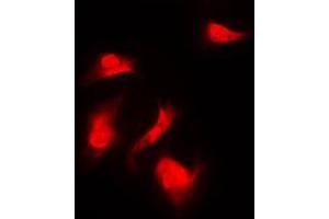 Immunofluorescent analysis of S6K1 (pS418) staining in HeLa cells. (RPS6KB1 Antikörper  (C-Term, pSer418))