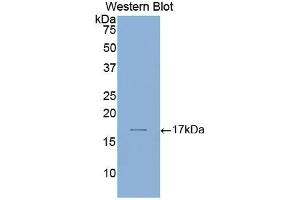 Western blot analysis of the recombinant protein. (Laminin alpha 1 Antikörper  (AA 2613-2746))
