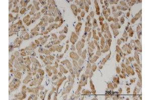 Image no. 1 for anti-2,4-Dienoyl CoA Reductase 1, Mitochondrial (DECR1) (AA 236-336) antibody (ABIN599370) (DECR1 Antikörper  (AA 236-336))