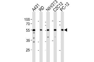 Western blot analysis of lysates from A431, RD, mouse NIH/3T3, mouse C2C12, rat PC-12 cell line (from left to right), using SRC Antibody (N-term) (ABIN1881832 and ABIN2838676). (Src Antikörper  (N-Term))