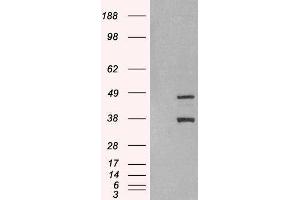 Western Blotting (WB) image for Sirtuin 3 (SIRT3) peptide (ABIN369690)
