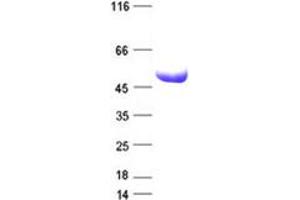 Western Blotting (WB) image for ATP-Binding Cassette, Sub-Family B (MDR/TAP), Member 1 (ABCB1) protein (His tag) (ABIN2713530)