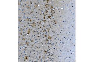 IHC analysis of LSM7 using anti-LSM7 antibody (ABIN7598937).