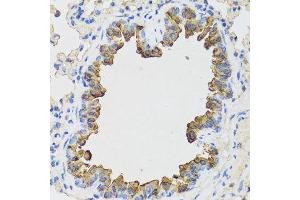 Immunohistochemistry of paraffin-embedded mouse lung using B9D1 antibody. (B9D1 Antikörper  (AA 1-130))