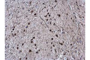 Immunohistochemistry (IHC) image for anti-SRY (Sex Determining Region Y)-Box 2 (SOX2) antibody (ABIN2855074)